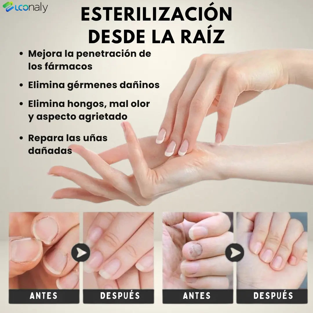 TitanNail™ – Uñas visiblemente sanas y fuertes en 7 días