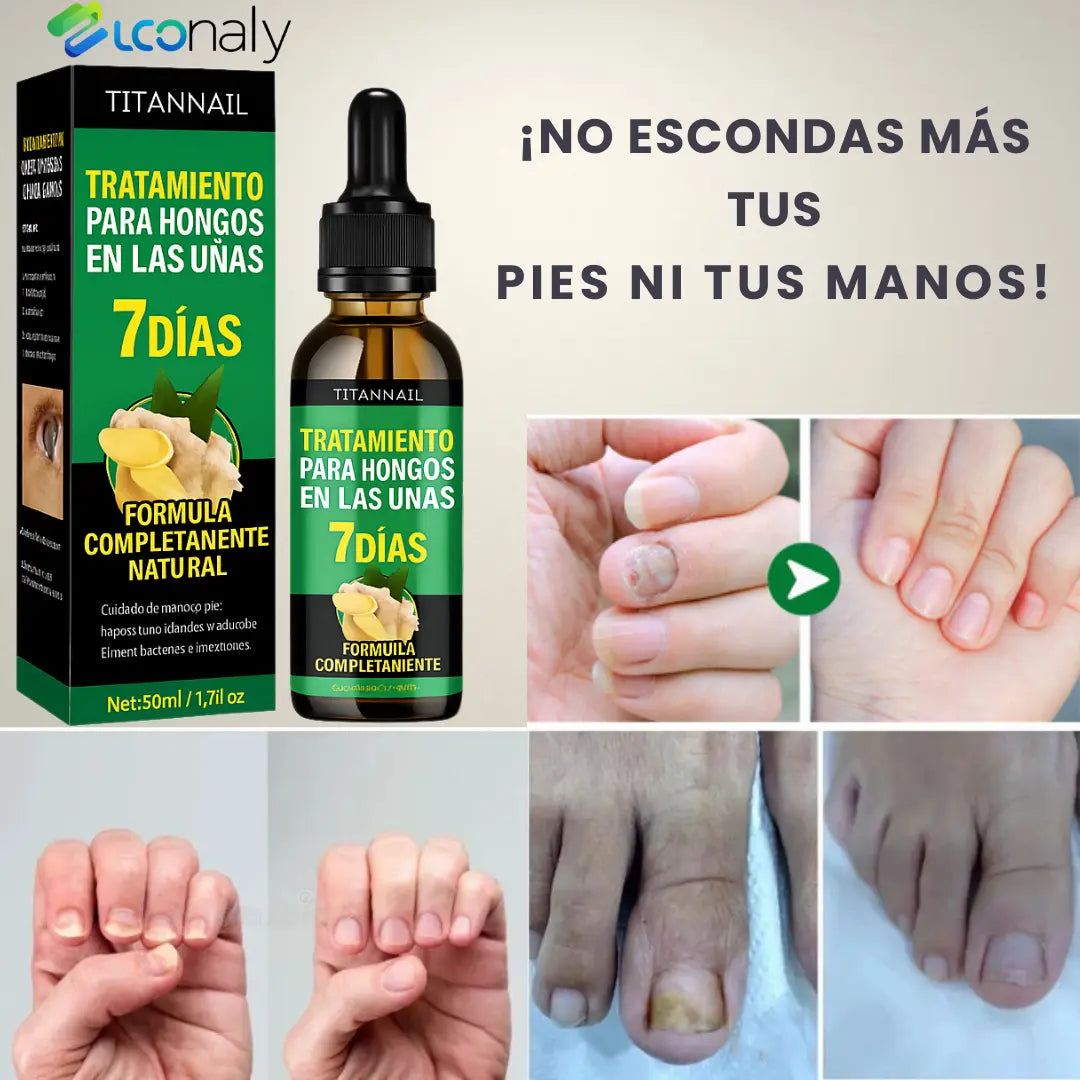 TitanNail™ – Uñas visiblemente sanas y fuertes en 7 días
