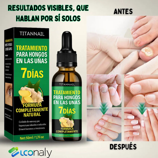 TitanNail™ – Uñas visiblemente sanas y fuertes en 7 días