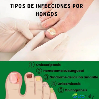 TitanNail™ – Uñas visiblemente sanas y fuertes en 7 días