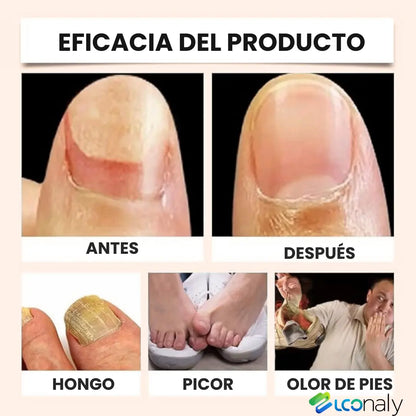 TitanNail™ – Uñas visiblemente sanas y fuertes en 7 días